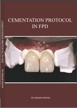 Cementation Protocol in FPD 