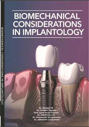 Biomechanical Considerations in Implantology