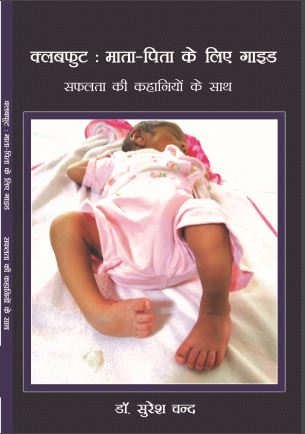 Clubfoot: Guide for parents (with success stories) by Dr Suresh Chand