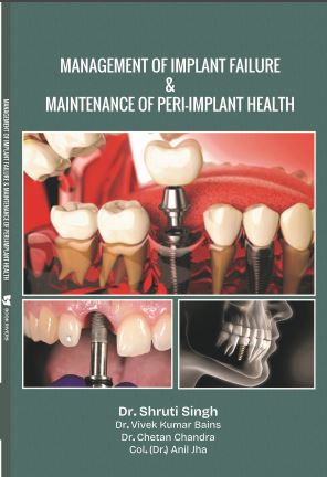 Management of Implant Failure & Maintenance of Peri-Implant Health 