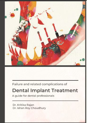 Failure and related complications of dental implant treatment – A guide for dental professionals