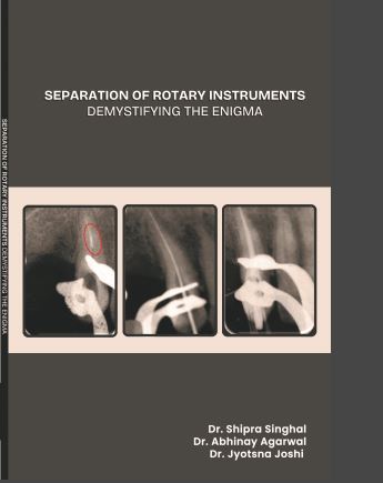 Separation of Rotary Instruments “Demystifying The Enigma”